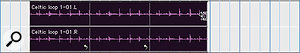 Depending on where in the Region Loop you click, the Loop Trim tool will either trim the number of iterations of a looped Region (above) or the length of the Region making up the loop (below). Depending on where in the Region Loop you click, the Loop Trim tool will either trim the number of iterations of a looped Region (above) or the length of the Region making up the loop (below).