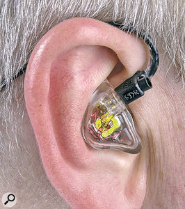 Westone Gennum's SD1 is a system that employs sub-miniature microphones mounted on custom-mouldable earpieces. The signals from the mics are fed through a DSP in the belt-pack (which can be configured using Mac and PC software), then fed to the user's ear. The wearer can set the amount of ambient signal they hear, while benefiting from the tight seal of the ear-mould. 